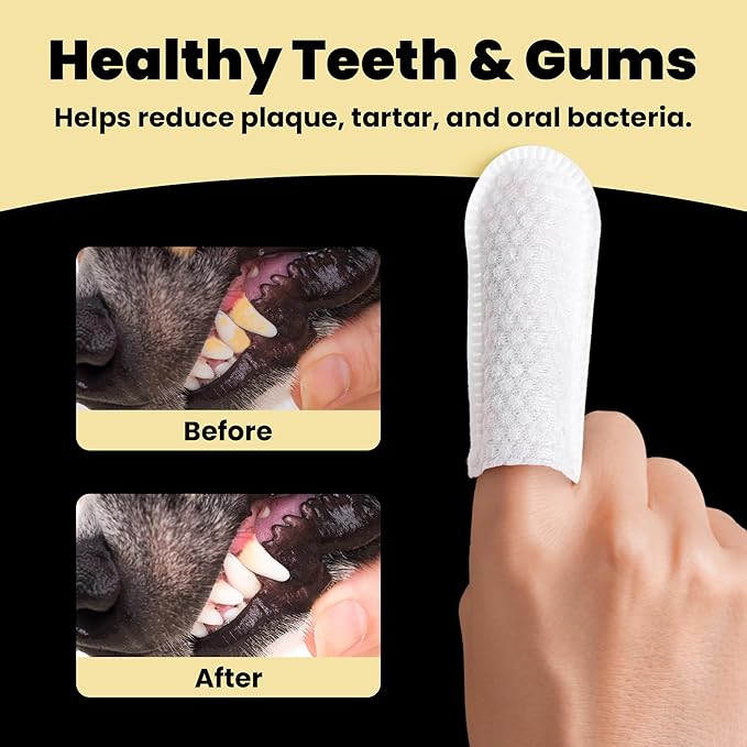 Hanu Dental Finger Wipes for Dogs & Cats - Teeth Cleaning Wipes Removes Bad Breath, Plaque & Tartar - Whitens Teeth Finger Toothbrush Gum Care Wipes - Freshens Breath - Vet-Recommended